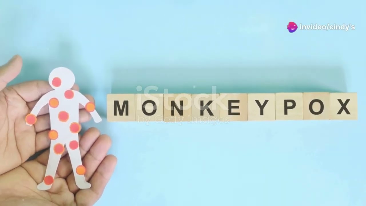 Mpox Virus: Stay Safe, Stay Informed! 🛡️🧼💉 