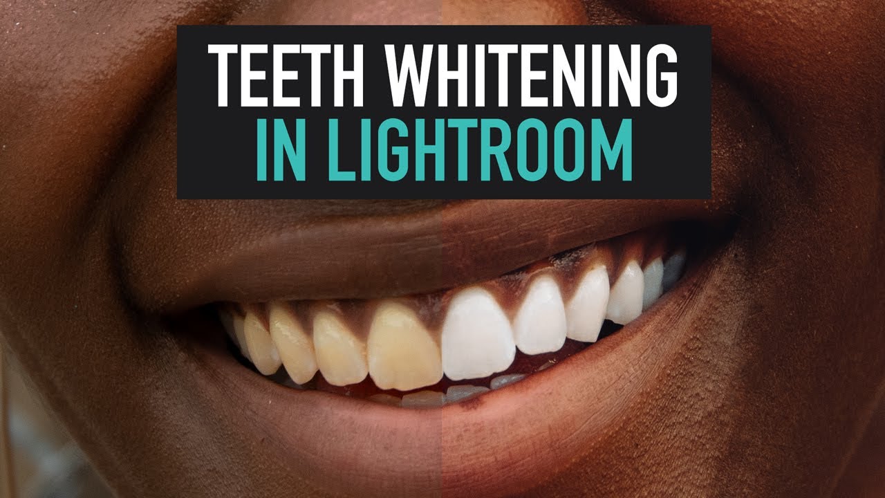 Quick Natural Teeth Whitening Technique in Adobe Lightroom Easy
