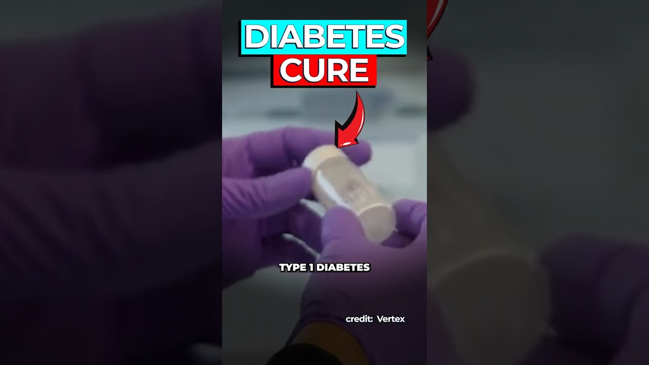 Scientists Cure First Type 1 Diabetes Patients