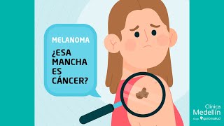 El Melanoma (cáncer de piel) - Riesgos, cuidados y señales de alerta