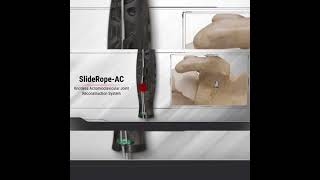 implants screws metal advance material biodegradable peek high strength tensile used in arthroscopy