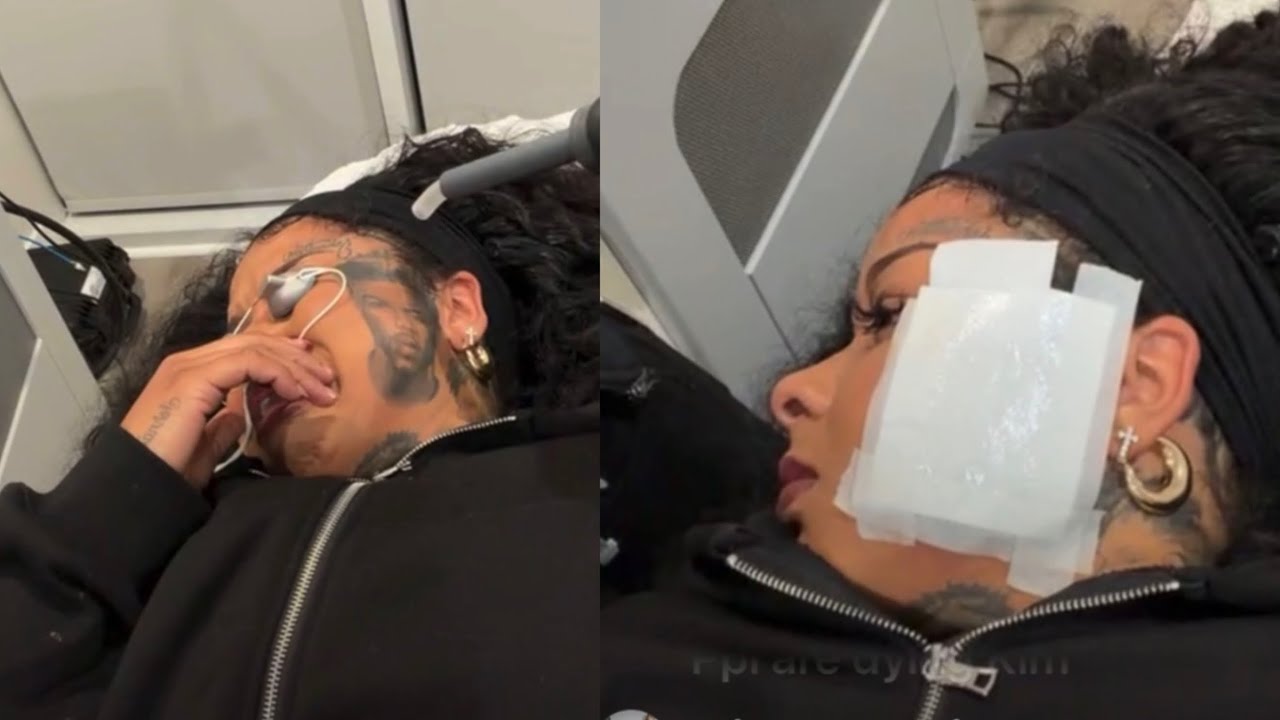 Chrisean Rock Gets Emotional Removing Blueface Tattoo — Raw