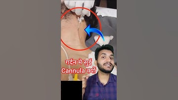 IV cannula kaise lagate hai #shorts