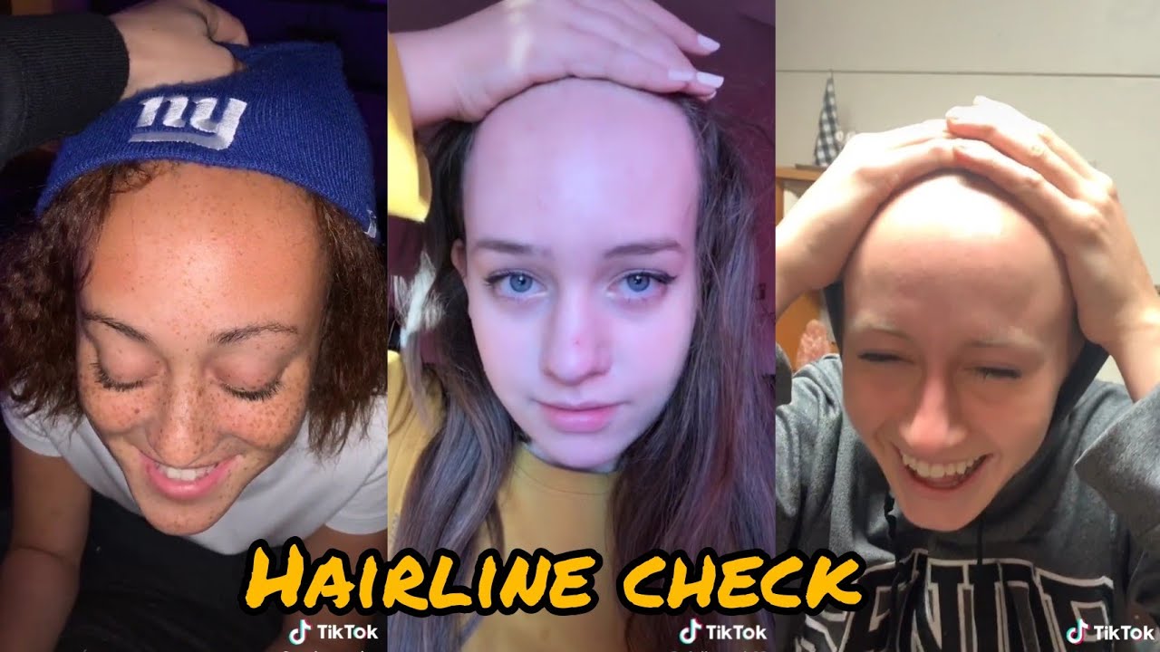 Hey yo hairline check ~ tiktok compilation - YouTube