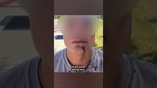 Man speaks out after tased by ICE, wrongfully detained in suburban Chicago