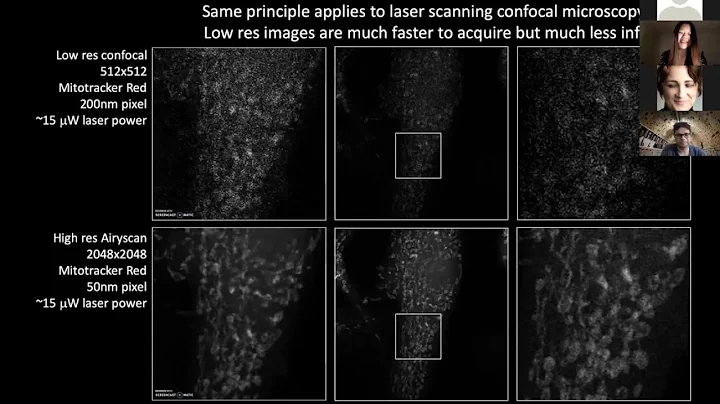 Linjing Fang - Deep learning-based point scanning super resolution imaging - Imaging ONEWORLD