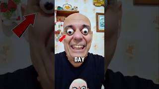 Why Did This Happen to This Man? 😨