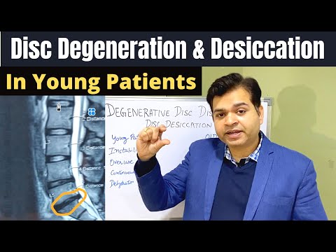 Disc Degeneration L5 S1, Disc Desiccation, Disc Degeneration Causes, DDD-Degenerative Disc Treatment