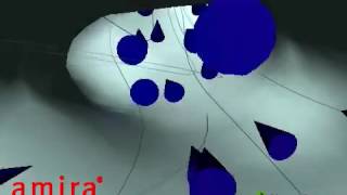 Amira | 3D visualization and analysis | Simulation of Blood flow in Aneurysm