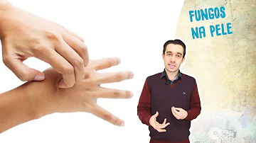 Como se prevenir de fungos na pele?