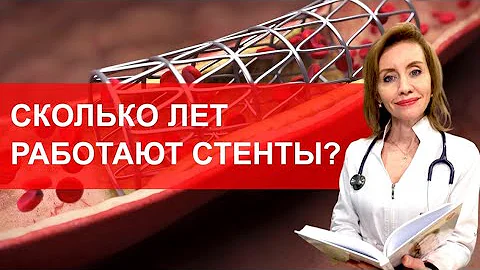 Сколько лет работают стенты?