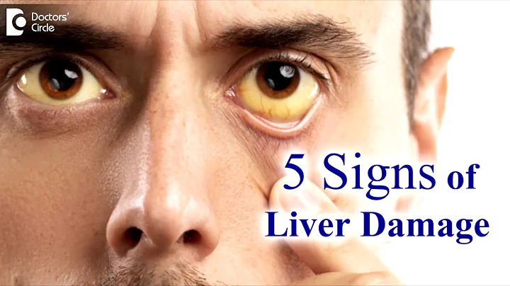 Liver disease Symptoms in adults. 5 Signs your liver is damaged - Dr. Ravindra B S | Doctors' Circle - DayDayNews