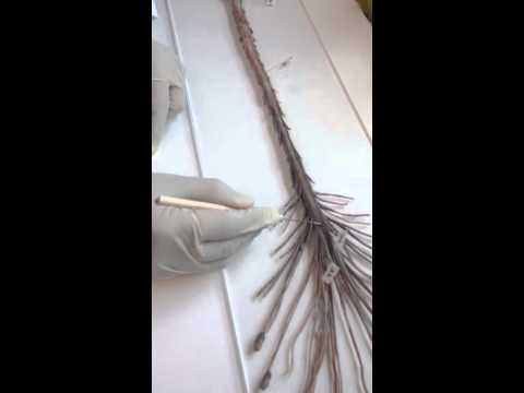 Video The spinal cord - YouTube