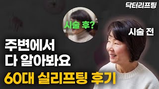 60대 실리프팅 받으면, 얼마나 효과 있을까? (ft. 실제 시술 후기)