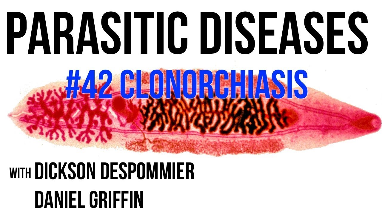 fascioliasis stressz