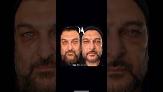 The Deep Aesthetics Beautification Package Creates Modelesque Features Using The Golden Ratio