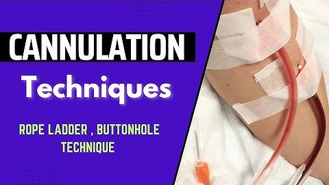 De essentiële gids voor dialyse met een av-fistelcanulatie | RRB KGMU Dialyse-interview