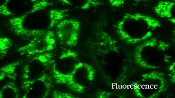 #VideoOfTheDay Mitochondria imaging with SLIM and fluorescence channels