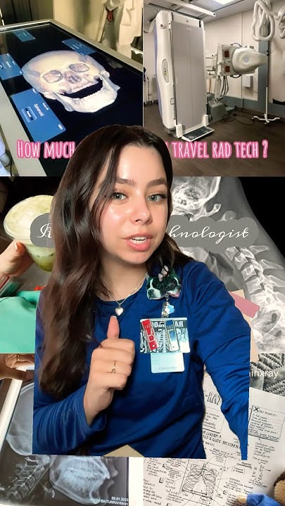 How Much Can You Get Paid As A Travel X Ray Tech student how-much-can-you-get-paid-as-a-travel-x-ray-tech-student