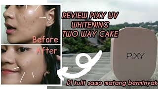 Review Jujur Pixy Facial Foam Anti Acne | Pengalaman Pakai 1 Bulan | Nayoo