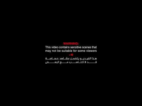 اعتداء على طبيبة نازحة في إب: جريمة موثقة