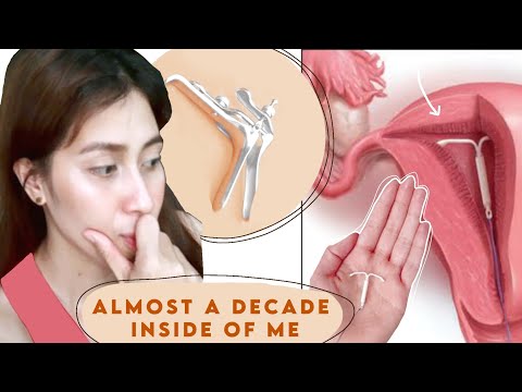 9 YEARS of EXPERIENCE with IUD || MASAKIT BA?