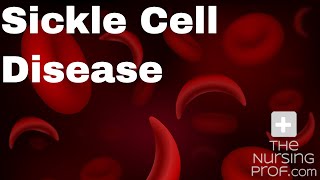 Sickle Cell Disease and Sickle Cell Crisis