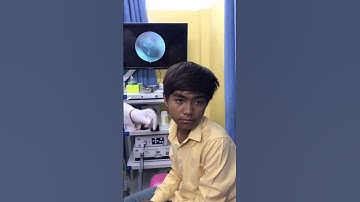 Doctor Shows What’s Inside the Ear 👂🩺 | Shocking Endoscopic View #ENT #Doctor