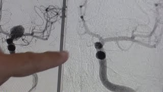 Neurology | Patient Story | Julia | Howell Allen Clinic with Ascension Saint Thomas
