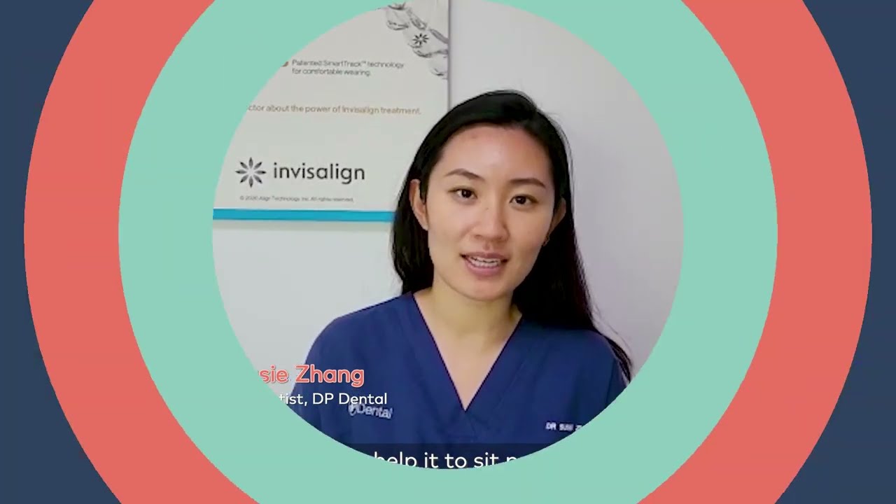 How often can you remove your Invisalign aligners? | DP Dental Singapore