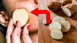 Сырой КАРТОФЕЛЬ может НЕВЕРОЯТНО изменить ВАШУ КОЖУ !! Вот КАК он ЭТО СДЕЛАЕТ... Сырой КАРТОФЕЛЬ может НЕВЕРОЯТНО изменить ВАШУ КОЖУ !! Вот КАК он ЭТО СДЕЛАЕТ...