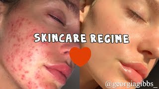 My skincare routine | bye bye acne & irritated skin | Georgia Gibbs unfiltered