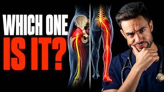 Piriformis Syndrome vs Sciatica: Doctor Explains How to Tell the Difference!