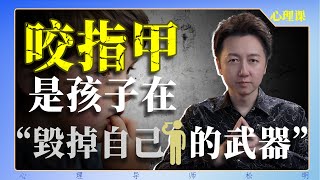 咬指甲，是孩子在“毀掉自己的武器”！