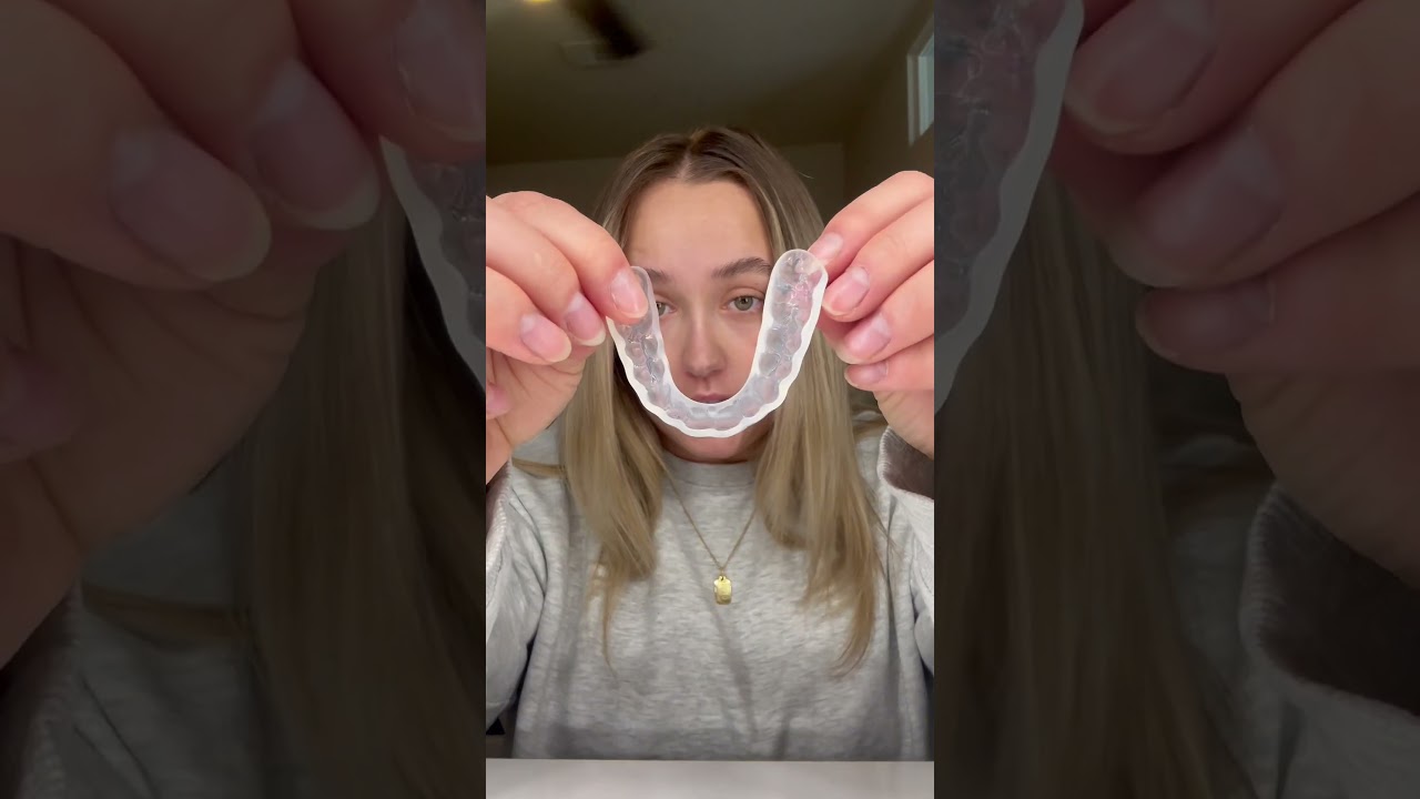 Why is my night guard turning yellow?