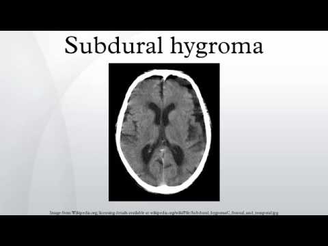 Video: Operasjon For å Fjerne Hygroma: Forberedelse, Stadier, Komplikasjoner