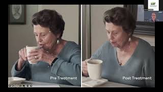 Treating Hand Tremors with the Cala TAPS Therapy