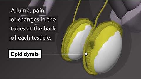 How to check your testicles | NHS