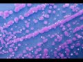 Group B Beta-Hemolytic Streptococci (GBS) - Microbiology Boot Camp