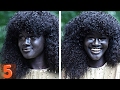 5  People With Unique Skin Colors