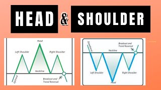 HEAD AND SHOULDER REVERSAL PATTERN | LEARN ENTRY,EXIT, STOP LOSS,TARGET