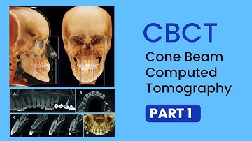 Read CBCT part 1 - Basics, Uses, Interpretations, Technical terms of Cone Beam CT #Scan