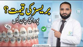 Braces Cost Stan Terhay Dant Ka Ilaj Braces Lagwain Ya Caps? Price Aur Farq Dr Aqeel Maqsood