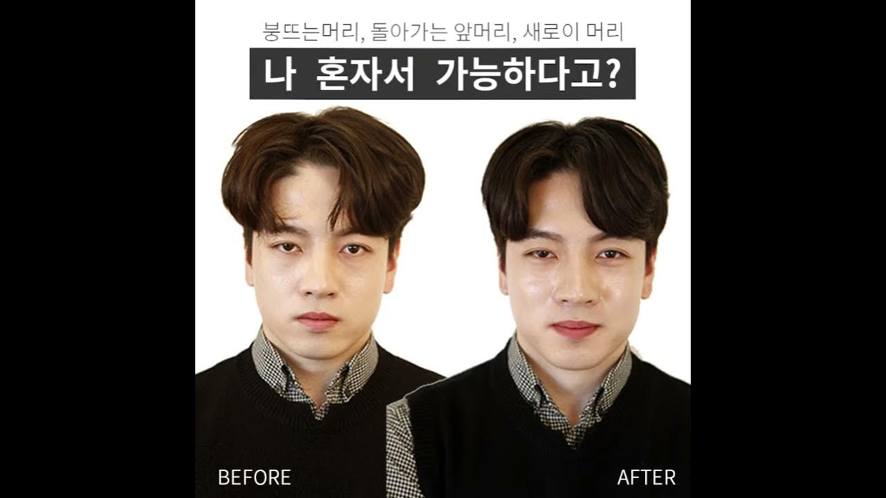 붕뜨는머리 뻗치는머리 돌아가는 앞머리 딱붙이고싶은머리 한번에 비에티 다운펌으로 - YouTube 붕뜨는머리 뻗치는머리 돌아가는 앞머리 딱붙이고싶은머리 한번에 비에티 다운펌으로 - Youtube
