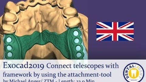 Exocad2019 - Tutorial preview - Connect telescopes with framework by using the attachment-tool