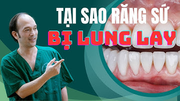 Tại Sao Răng Sứ Lung Lay? Hướng Dẫn Khắc Phục và Phòng Ngừa Hiệu Quả - Số 180 | Dr Phùng Khoa