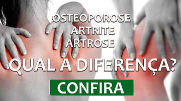 O que é bom para artrite osteoporose?