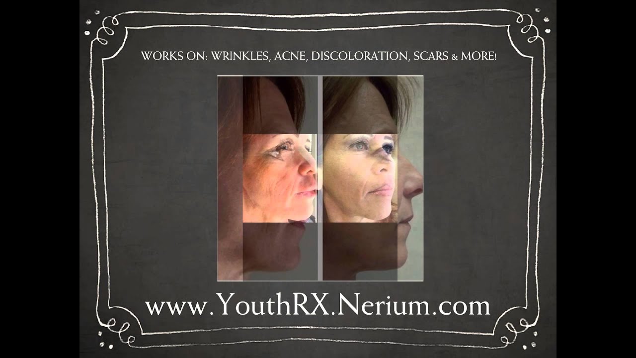 Nerium Before & After