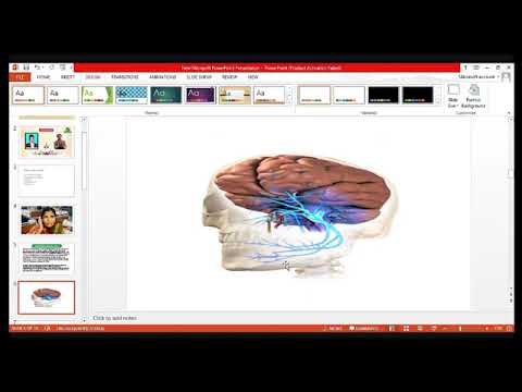 Panchbhautik Chikitsa Case study in Trigeminal Neuralgia