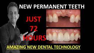 Guided dental implant surgery-Amazing painless dental implants technology for teeth fixing